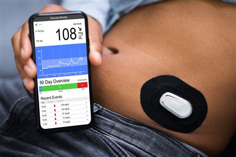 Can You Swim with Dexcom G6? Exploring the Depths of Continuous Glucose Monitoring