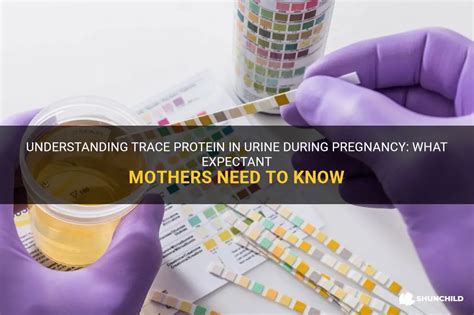 Is Protein in Urine Normal During Pregnancy? Exploring the Mysteries of Maternal Health